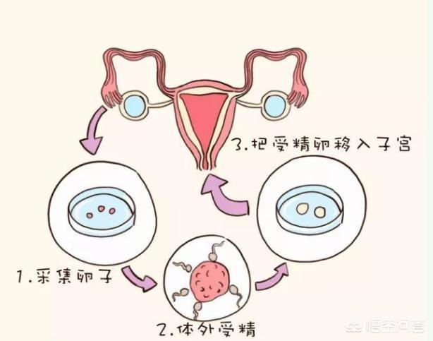 代孕